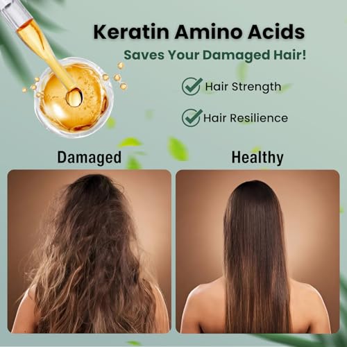 Moist Diane Anti Dandruff Shampoo for Women & Men, Itchy Scalp Shampoo for Oily Hair by Keratin, Tea Tree, Mint, Rosemary& Argan Oil, Silicone & Paraben Free from Japan 15.2 Fl Oz EXTRA FRESH& HYDRATE